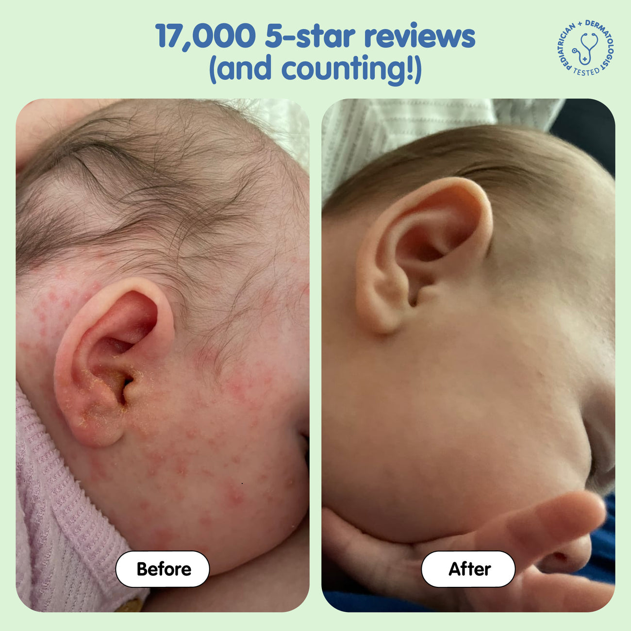 TUBBY TODD All Over Ointment Baby Eczema Cream